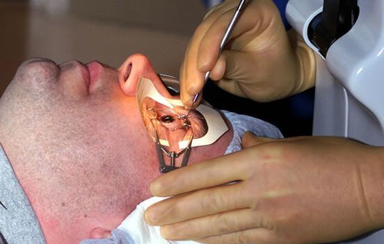 Scleroplasty para sa myopia upang patatagin ang paningin